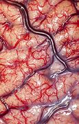 Image result for Human Brain Photography