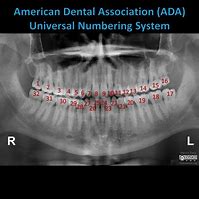 Image result for Radiography Number Organizer