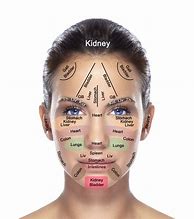 Image result for Face Mapping Acne