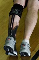 Image result for Ideo Ankle