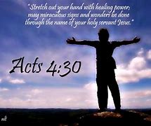 Image result for Acts 4 Verse 7