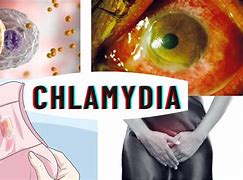 Image result for Chlamydia Disease Symptoms in Women