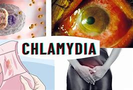 Image result for Chlamydia Images Women