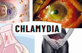 Image result for Chlamydia Images Men