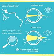 Image result for CA DMV Eye Test Chart