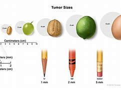Image result for Tumor Size Chart Fruit