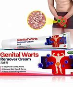 Image result for Treatment of Genital Warts