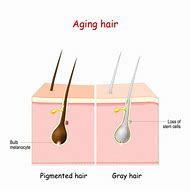 Image result for Melanin and Gray Hair