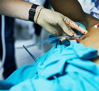 Image result for Patient with Chest Tube