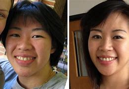 Image result for Difference Between Chinese and Japanese Faces