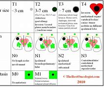 Image result for Lung Cancer Nodules Size Chart