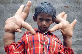Image result for Giant Hands Small iPhone