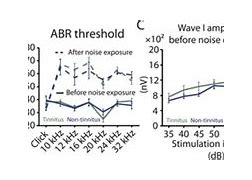 Image result for tinnitus