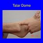 Image result for Styloid Process Foot