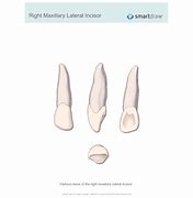 Image result for Right Lateral Insicor Drawing
