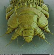 Image result for Scabies Bug