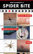 Image result for Australian Spiderbites
