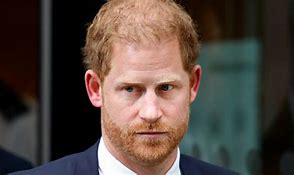 Image result for Prince Harry Hair Before and After
