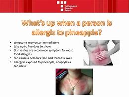 Image result for Pineapple Allergy Rash