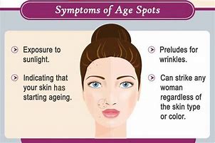 Image result for Age Spots Symptoms