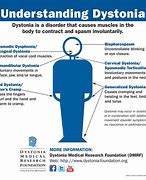 Image result for Dystonia