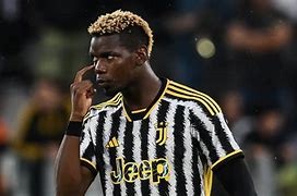 Image result for Pogba Juventus Blood