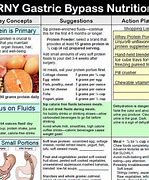 Image result for Gastric Bypass Surgery Diet