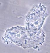 Image result for Clue Cells