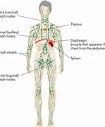 Image result for 2 Cm Lymph Node