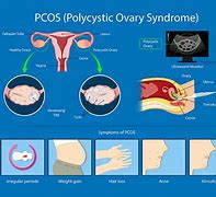 Image result for Pcod Images
