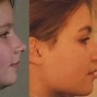 Image result for Mewing Forward Face