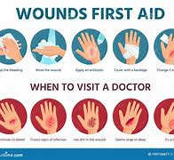 Image result for aid�n