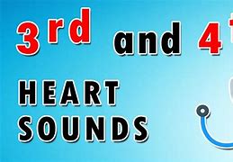 Image result for S3 and S4 Heart Sounds Images