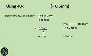 Image result for Actual Size of 11Mm