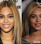 Image result for Beyoncé Plastic Surgery