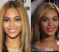 Image result for Beyonce Face Lift