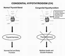 Image result for Thyroid Symptoms Men