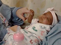 Image result for Smallest Babies Born