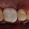 Image result for 8002A Tooth