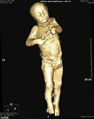 Image result for Pompeii Bodies Preserved