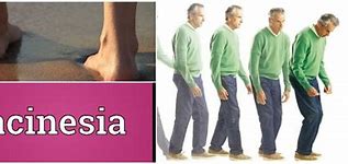 Image result for axinesia