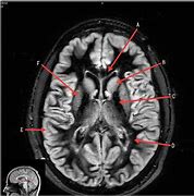 Image result for Brain Location in Head