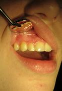 Image result for Helena Bonham Carter Teeth