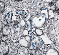 Image result for Covid 19 Electron Microscope