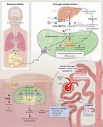 Image result for Salicylate Toxicity Chart