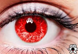 Image result for Rare Eye Colors in Humans