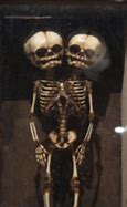 Image result for Two-Headed Skeleton