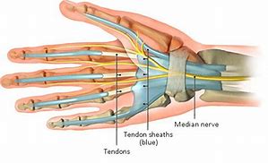 Image result for Sheaths for Fingers