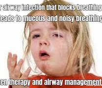 Image result for Meme On Airway