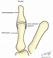 Image result for Thumb Tendon Injury